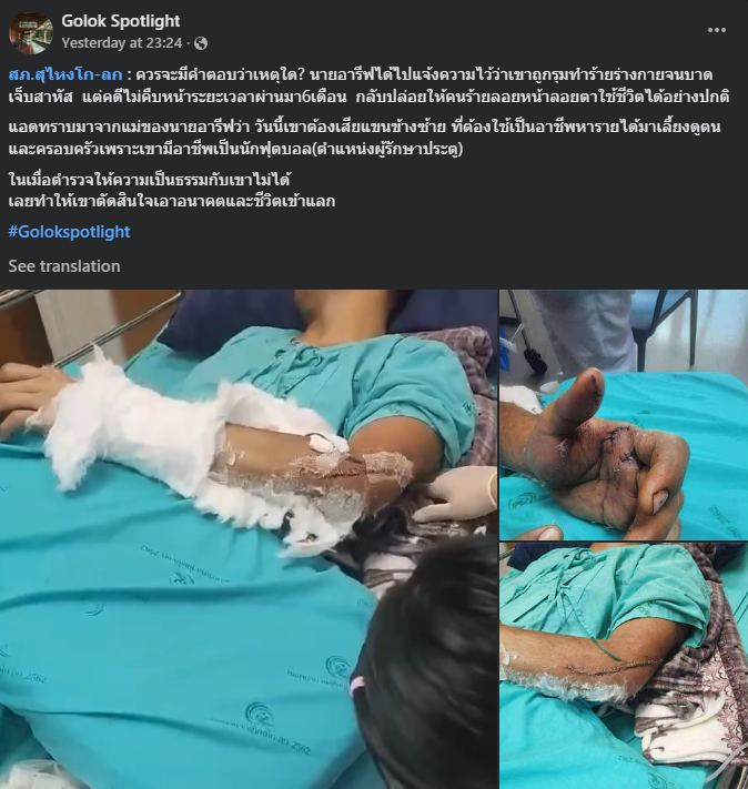 Suspek kes tembak di Golok ditetak sebelum kejadian 2