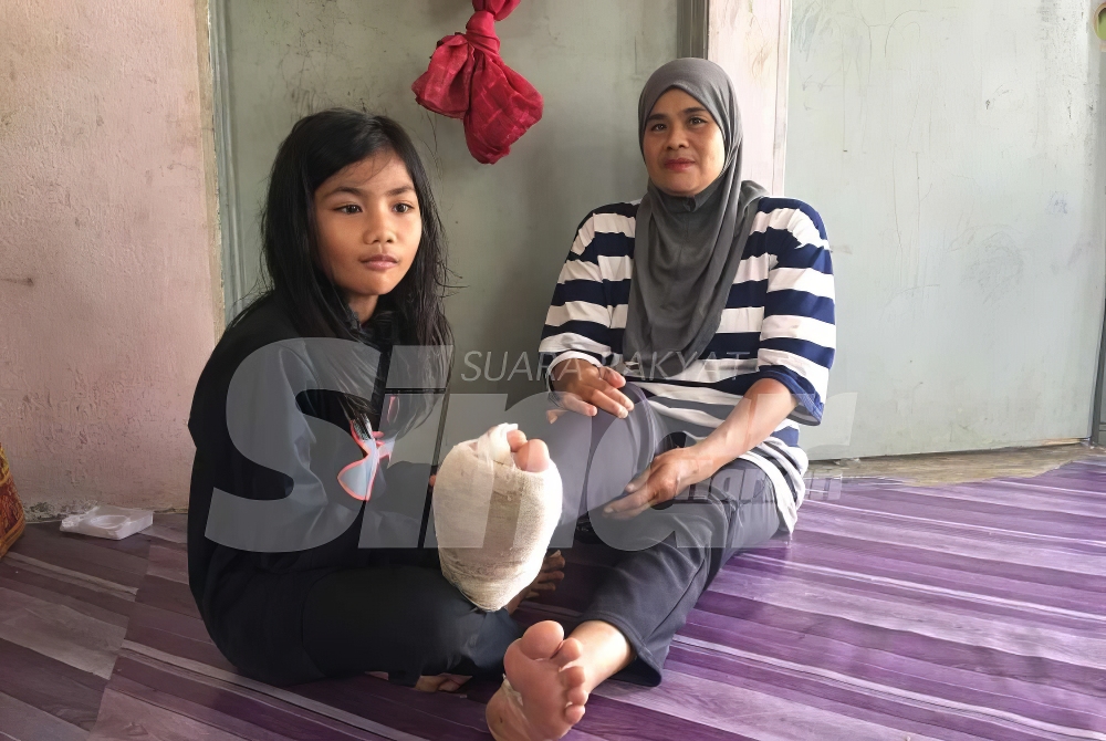 Hasmawati (kanan) menunjukkan kaki kanannya yang berbalut selepas dicuci.