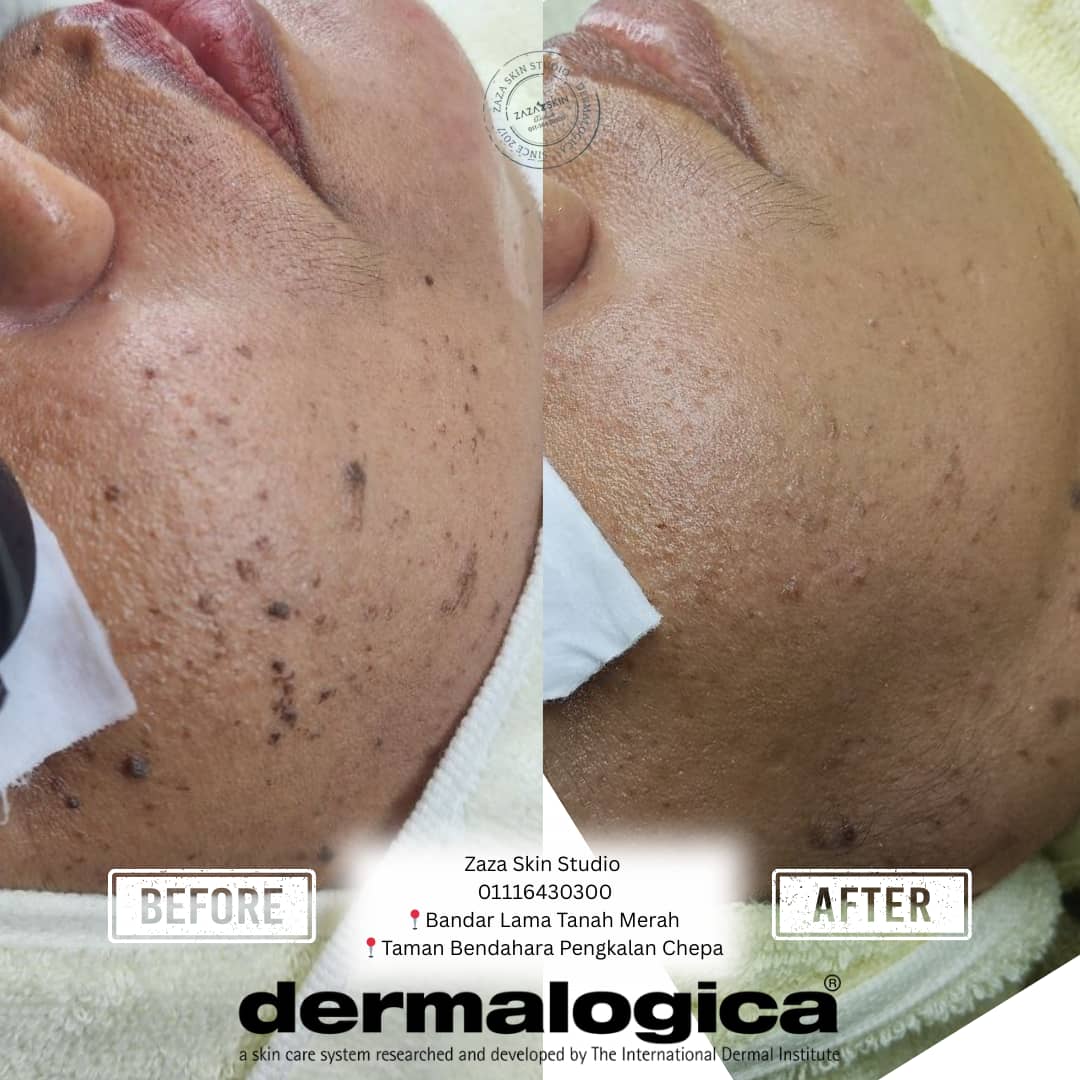 Rawatan Dermalogica Kelantan